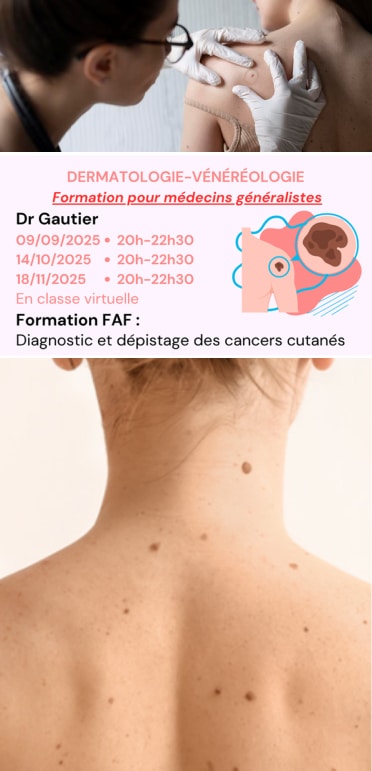 diagnostique et dépistage des cancers cutanés